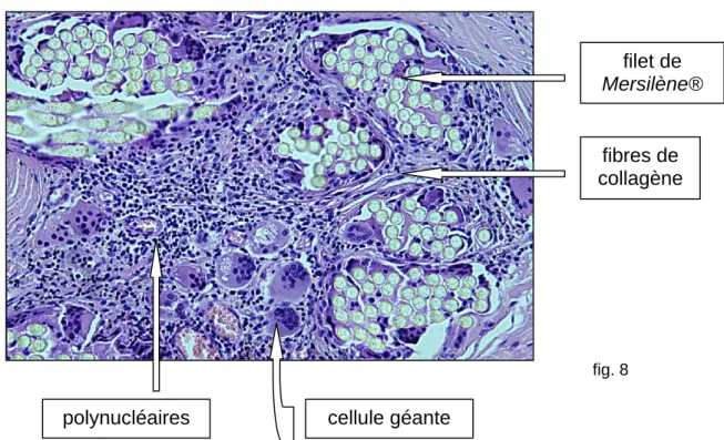 fig. 8  polynucléaires cellule géante