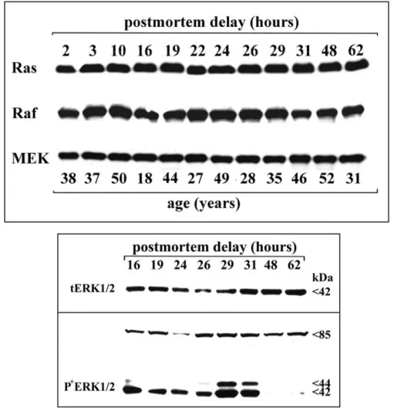 Figure 10. Effet du PMD et de l’âge sur les taux d’immunoréactivité des protéines de la 