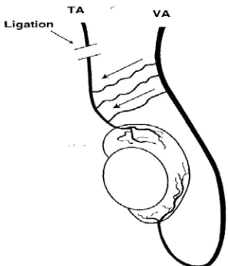 Figure 8 : Ligature haute de l’artère spermatique. 99                                           VA : vasal artery
