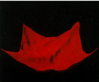 Figure II-10: Computation of the cloth shape using catenary surfaces [WEIL 86] 