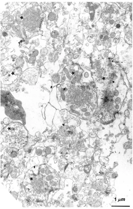 Figure 3.1.1. Synaptosomes des fibres moussues d'hippocampe de rat. Image en  microscopie électronique conventionnelle à faible grossissement de la préparation.