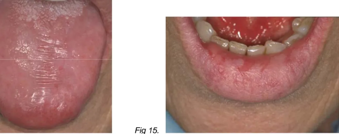 Fig 14.     Fig 15.   