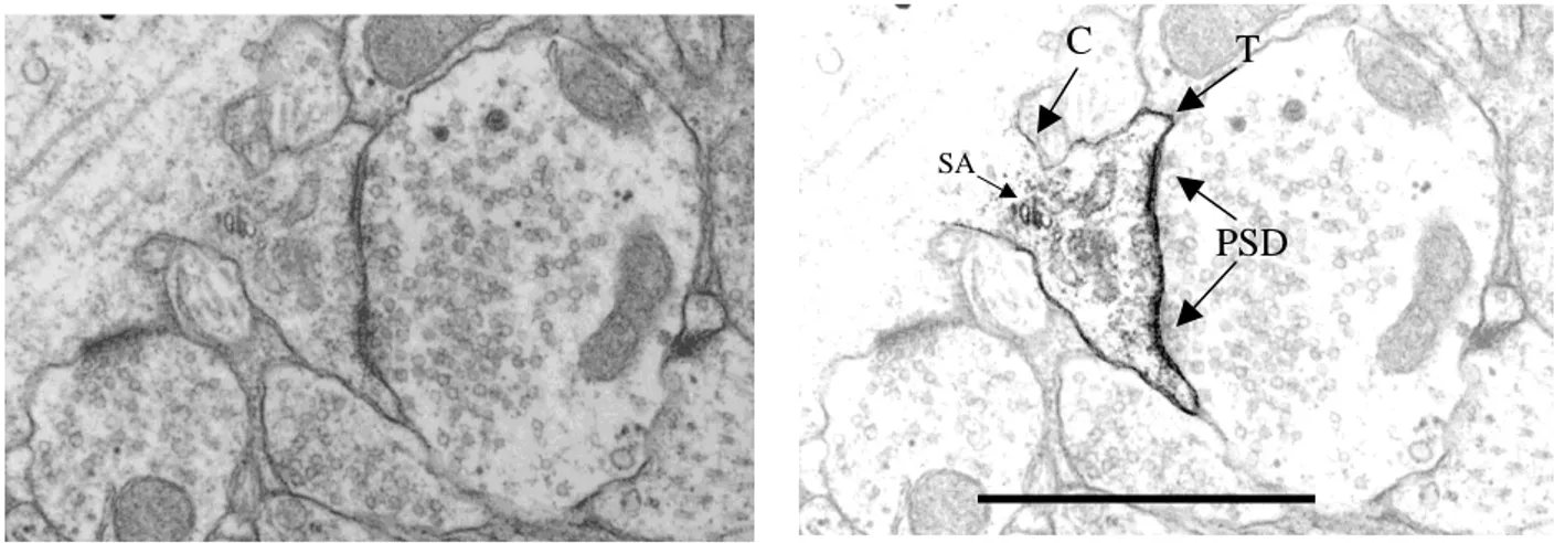Figure 8 : Epines dendritiques de type I, hippocampe de rat, CA1. C : Cou, T : Tête, PSD :