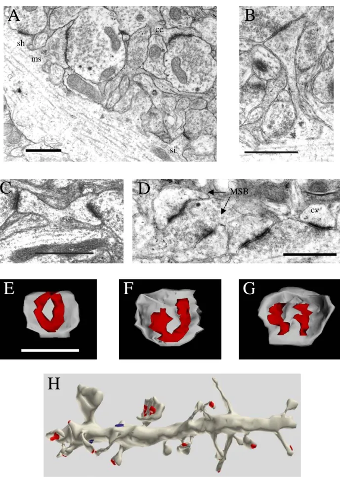 Figure 10 : Différents types d’épines dendritiques : A : Synapse de type shaft (sh), mushroom (ms),