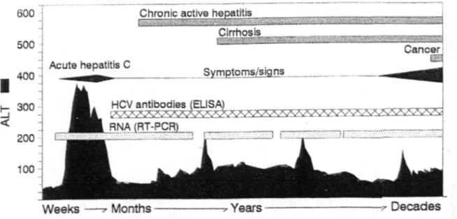Figure 4 :  Histoire naturelle de l’infection par le HCV 