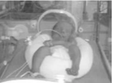 Figure 5 : Positionnement de l'enfant dans un "nid" sur le dos (Palix, 2008, p