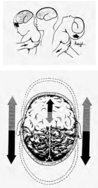 Figure 1 : Mécanisme de survenue du syndrome de l’enfant secoué. 