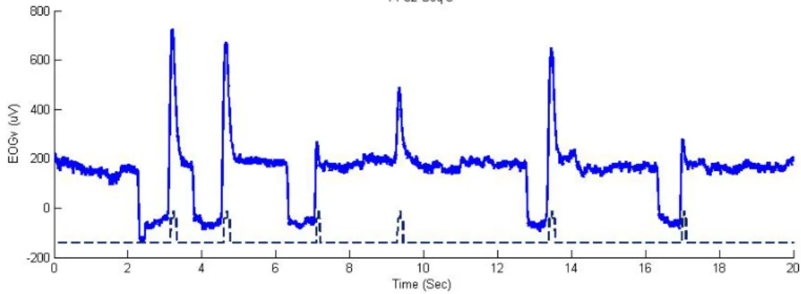 Figure  2-5: Deux mouvements d’œil vers le haut, vers 7s et 17s, sont identifiés comme des clignements