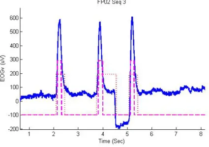 Figure  2-8: Proximité entre un mouvement d'oeil et un clignements d'œil 
