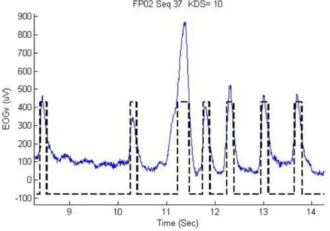Figure  2-17 : Une séquence d’EOG contenant six clignements simples et un long clignement