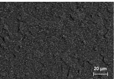 Figure II. 17 : Micrographie MEB, en électrons rétrodiffusés, d’une éprouvette mouchetée 