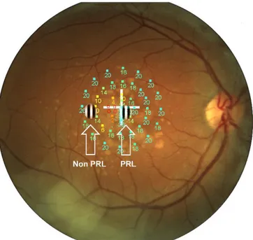 Figure 1. Illustrative example of stimuli placement.  