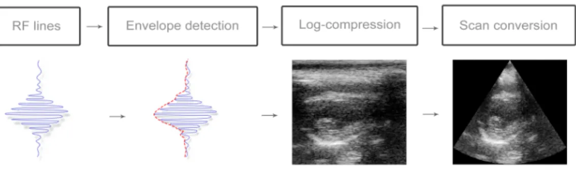 Figure 1.5: Transformations used to obtain B-mode images from the original RF data.