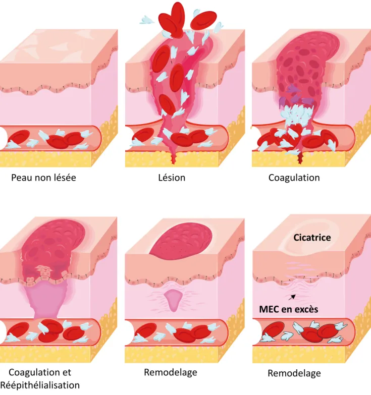 Figure 8. Cicatrisation : exemple de la peau.