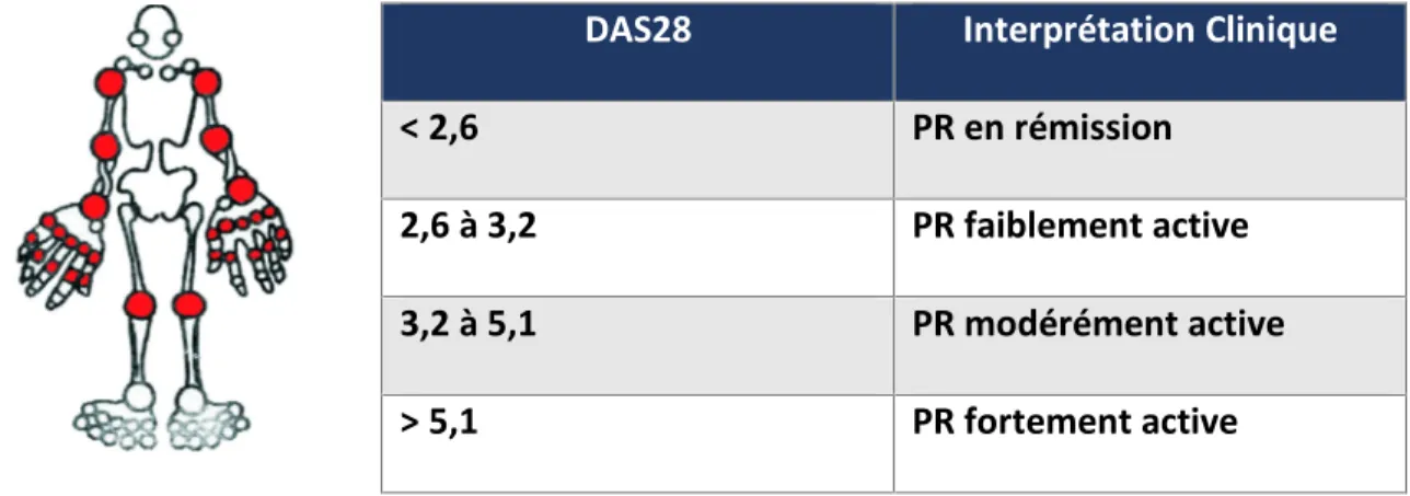 Tableau 2. Evaluation clinique de l activité de la PR en se basant sur le DAS28 (26).