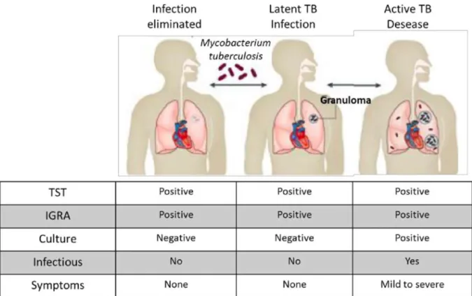 Figure 7: Spectrum of tuberculosis disease and associated diagnosis (adapted from [35])