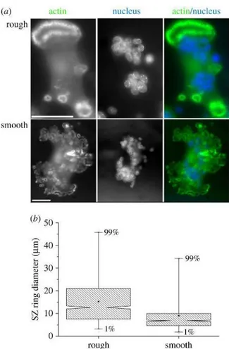 Figure 1.31.: Osteoclasts adhering to diﬀerent bone topographies diﬀer in the size of their sealing zone rings