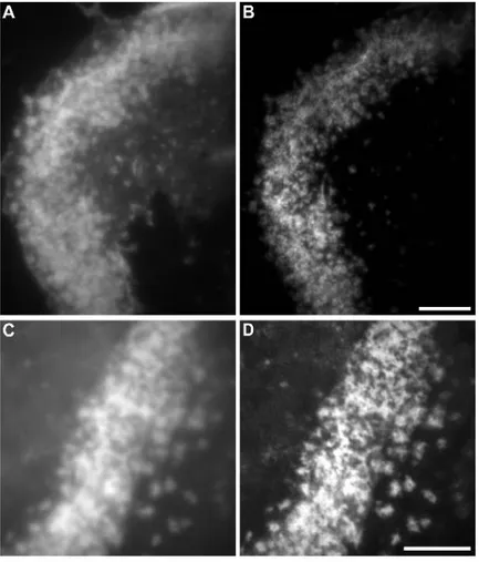 Figure 2.2.: Comparison between epi-fluorescence and RIM super-resolution microscopy. (A) Widefield image of the sealing zone already shown in Fig