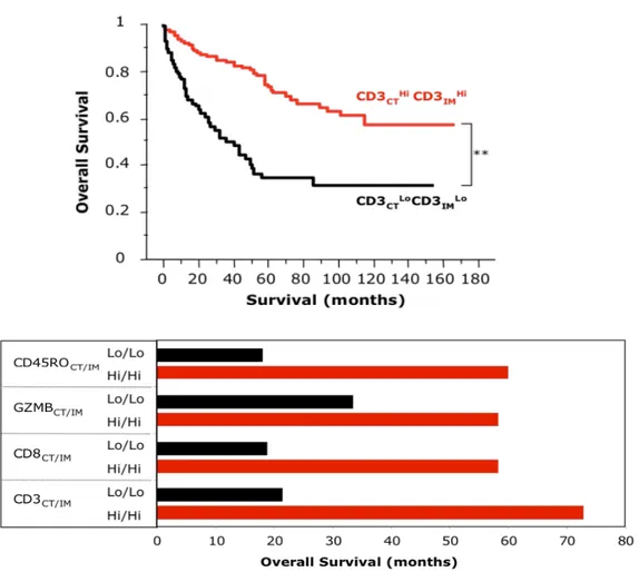 Figure 4 :  Une forte densité d’infiltrat de lymphocytes T (caractérisés par l’expression du CD3) dans les zones centrales et  marginales de la tumeur (High/High) augmente le temps de survie globale des patients atteints de cancer colorectal