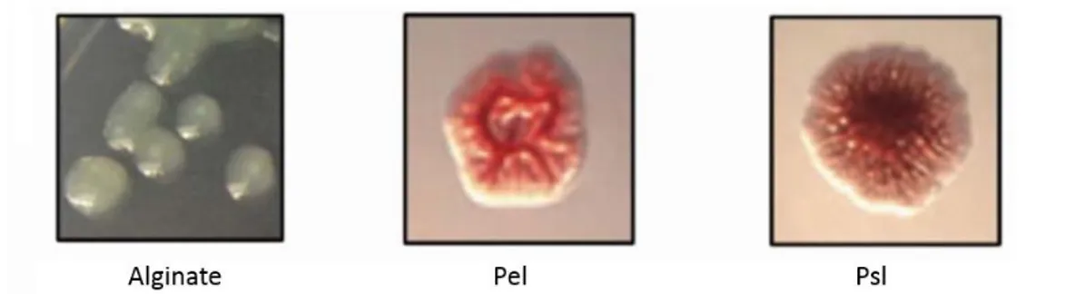 Figure 3 : Phénotypes des colonies de P. aeruginosa dû à la surexpression d’ePS, A) souche de 
