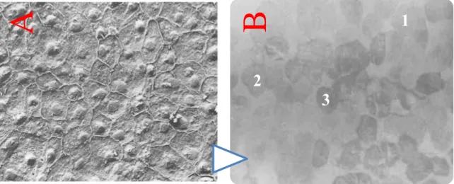 Figure 7. Microscopie électronique  à balayage de la face apicale des 