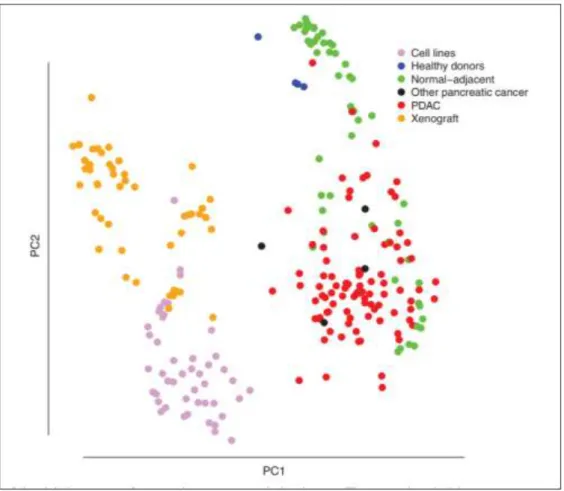 Figure 4 : Analyse en composante principales des profils d’expression géniques de  différents échantillons pancréatiques (Gadaleta et al