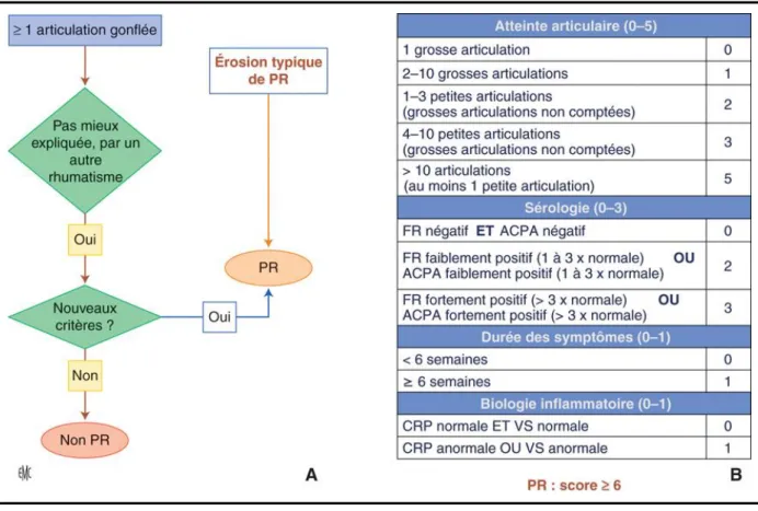 Figure 13. Critères ACR/EULAR 2010 pour la classification et le diagnostic de la polyarthrite rhumatoïde