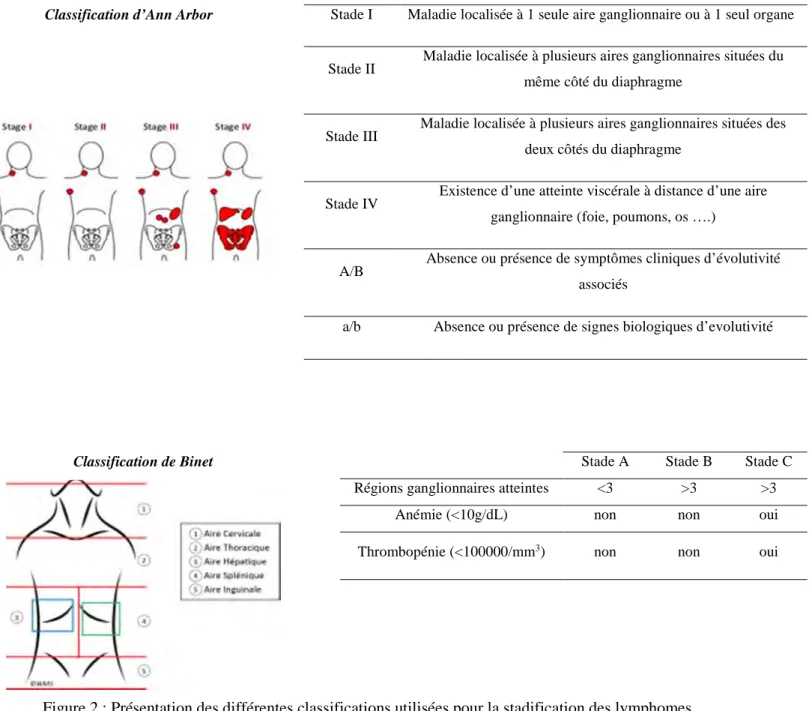 Figure 2 : Présentation des différentes classifications utilisées pour la stadification des lymphomes