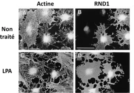 Figure 8 : Effet de la surexpression de RND1 sur la formation des fibres de stress d’actine