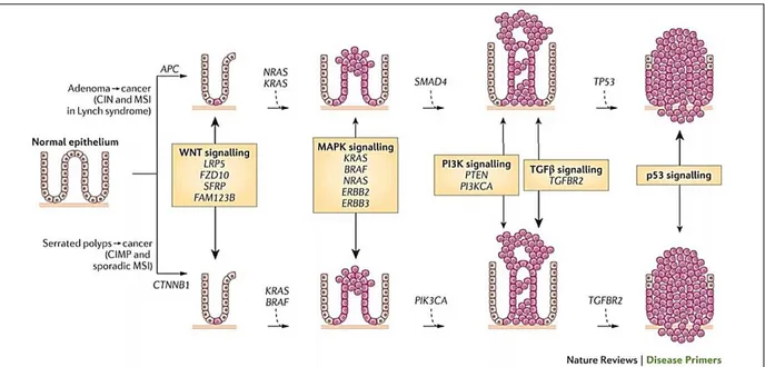 Figure 13 : La séquence de carcinogenèse colorectale du polype au cancer 