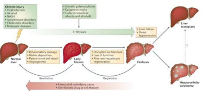 Figure	 2	:	 Schéma	 de	 l’évolution	 des	 maladies	 chroniques	 du	 foie	 [3] 	 (Figure	 extraite	 de	 la	