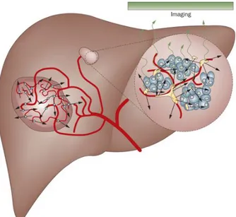 Figure	4	:	Mécanisme	d’action	des	microsphères	et	du	Lipiodol	radiomarqué	sur	les	tumeurs.	