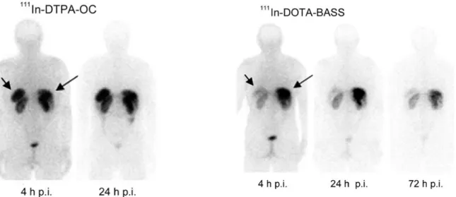 Figure	18	:	Image	d’une	scintigraphie	corps-entier	réalisée	chez	un	patient	avec	les	composés	