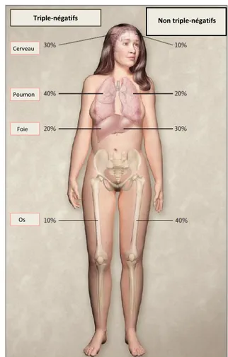 Figure 4. Sites de rechutes métastatiques  dans les cancers du sein triple-négatifs et  non triple-négatifs
