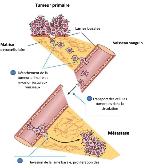 Figure 7.  L’invasion dans le modèle de la cascade métastatique.