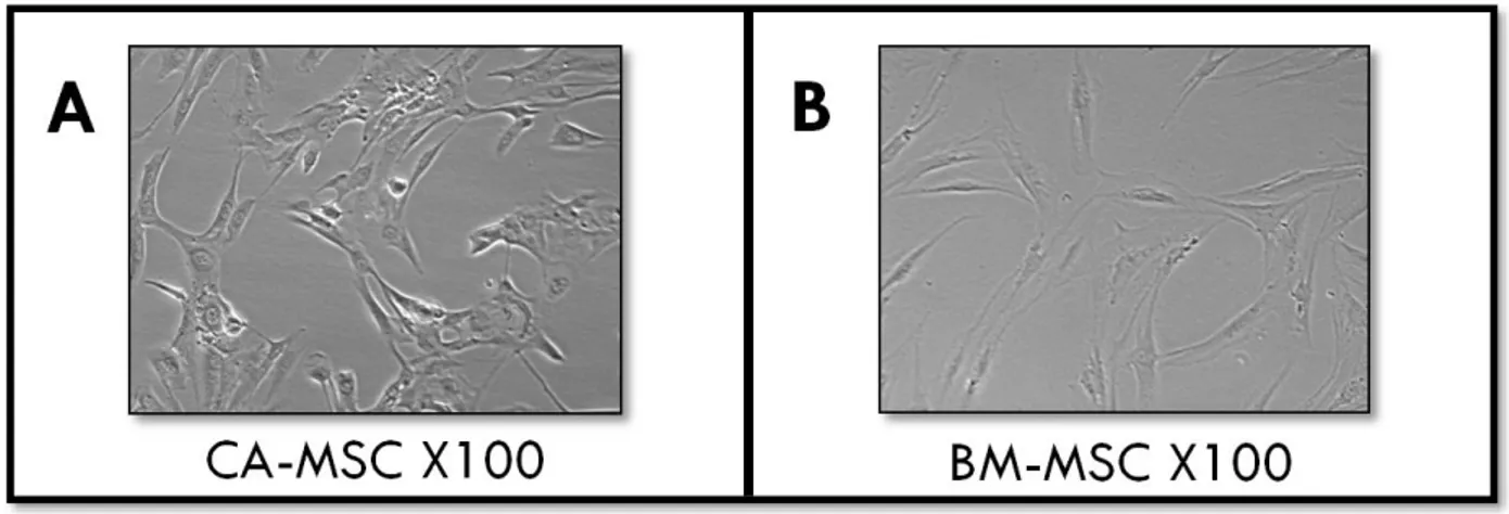 Figure 10 : Expression membranaire de marqueurs caractéristiques de MSC d’une culture de cellules isolées de  tumeurs ovariennes