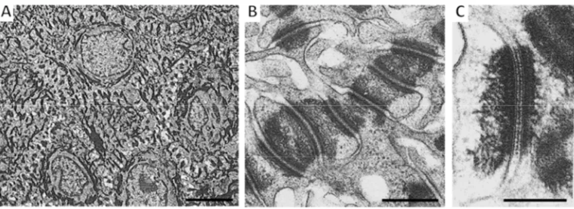 Figure 6 : Aspect &#34;épineux&#34;  et desmosomes de la couche épineuse observés en microscopie électronique à  transmission