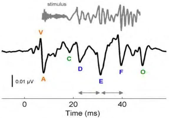 Figure  1.20:  Transient  and  sustained  features  in  the  ABR  to  a  sound,  /d ɑ/  :stimulus 