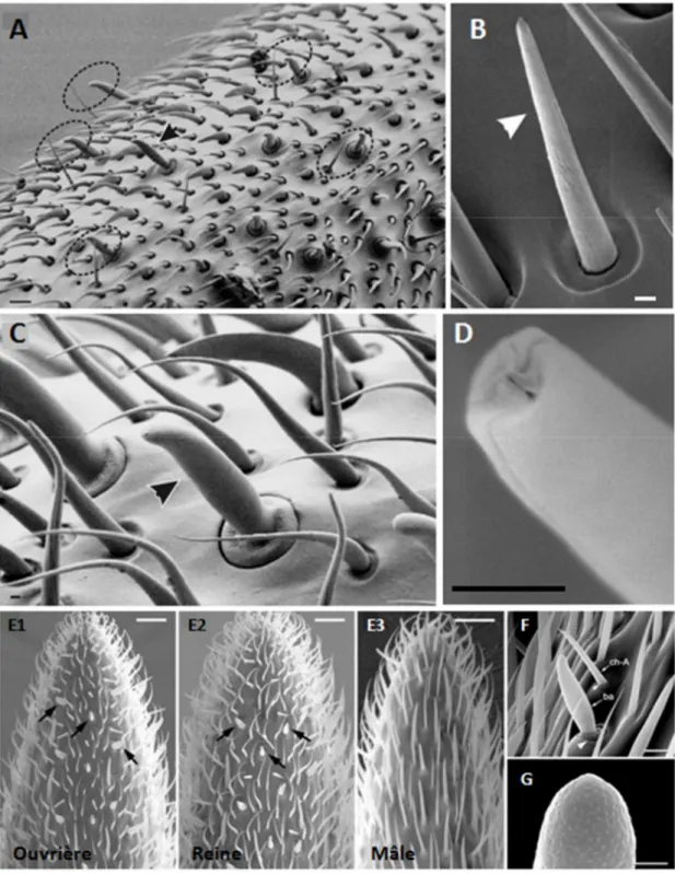 Figure 3. Structure de sensilla basiconica et sensilla trichodea observées en microscopie électronique 