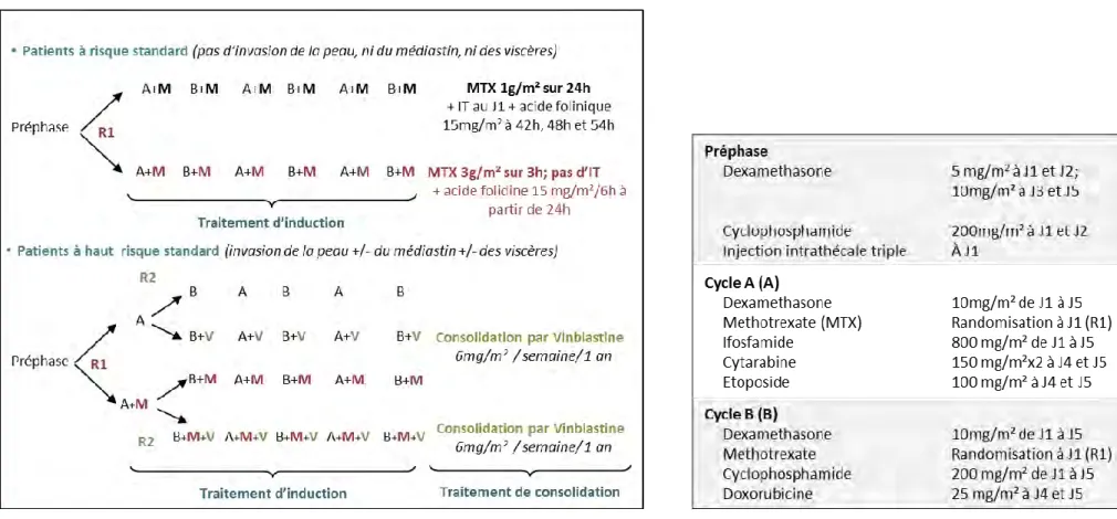 Figure 14 : Plan de traitement de l’essai clinique ALCL99 