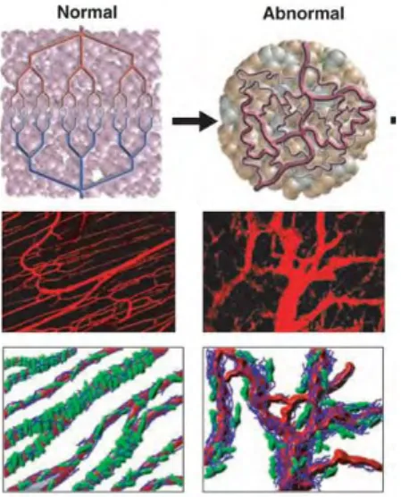 Figure  12 :  Comparaison  de  la  vascularisation  normale  et  tumorale.  Dans  le  tissu  normal  les 