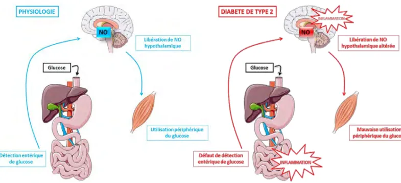Figure 23: Axe intestin-cerveau et inflammation: cas du Diabète de Type 2. 