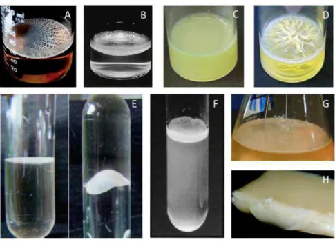 FIGURE  A-5.  Exemple  d'espèces  bactériennes  formant  des  pellicules  aux  interfaces  air-liquide