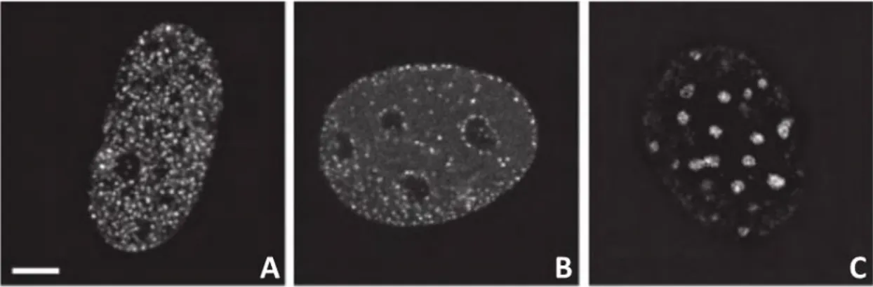 Figure 6 : Distribution des foyers de réplication au cours de la phase S. Image tirée de (Baddeley et al.,  2010) 