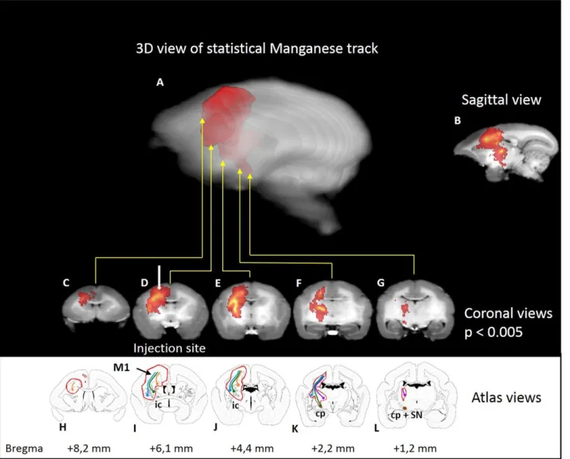 Fig 3.  Statistical parametric maps of manganese in seven marmosets. Statistical parametric maps of manganese after injection (blue point) in the  primary motor cortex (M1) of seven marmosets (p<0.005 uncorrected)
