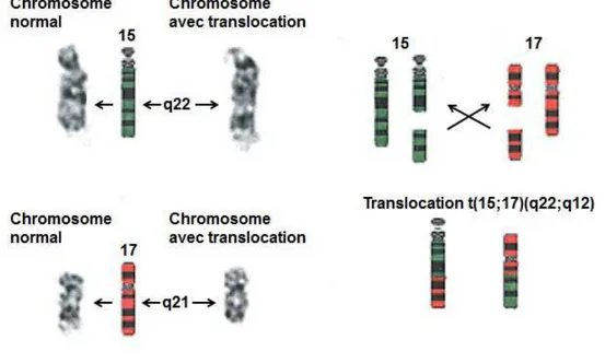 Figure 4 : Mécanisme de translocation chromosomique entre le chromosome 15 et 17 générant la  translocation t(15;17)(q22;q12) et la protéine chimérique PML-RARα