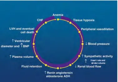 Figure 11. Le mécanisme de la rétention d'eau et l'insuffisance cardiaque provoqués par l'anémie  (333) 