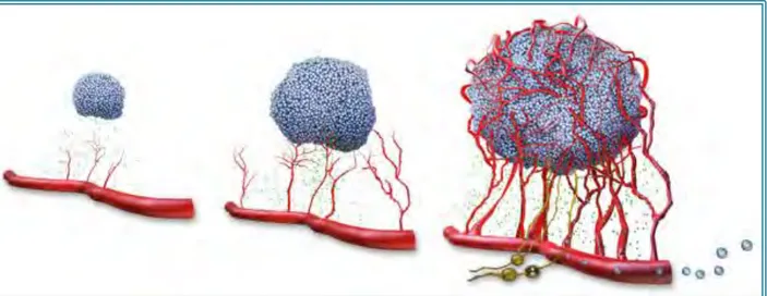 Figure 4. Le switch angiogénique. Au fur et à mesure de la progression de la tumeur, un processus de  néoangiogenèse et de lymphangiogenèse se met en place, permettant l’approvisionnement de la tumeur  en oxygène, en nutriments mais aussi en offrant une vo