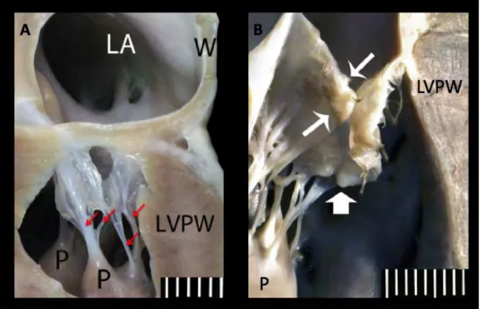 Figure 2. (A) Sagittal section through the left atrium (LA) and the left ventricle of a dog with a  normal  mitral  valve  apparatus