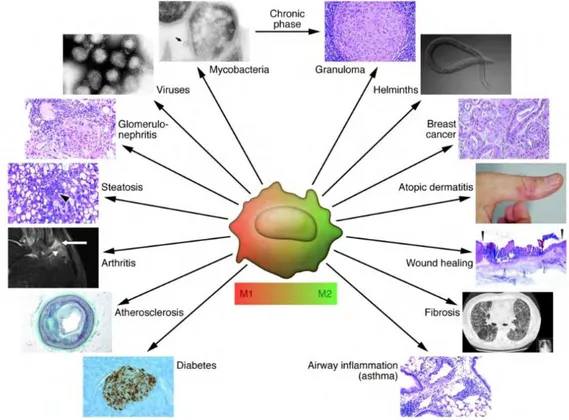 Figure  10.  Représentation  schématique  de  la  polarisation  des  macrophages  dans  différentes  pathologies